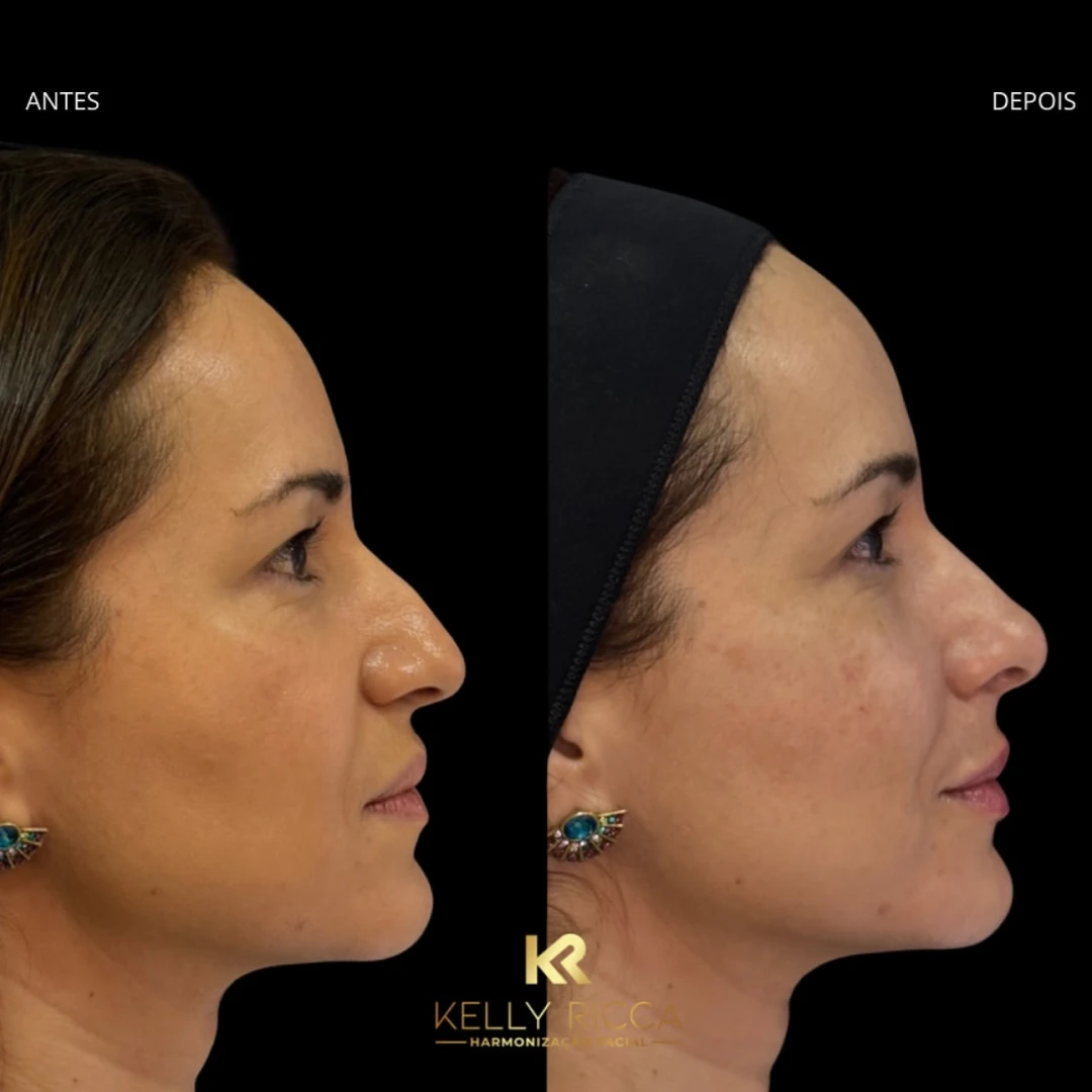 a7e91c5f_7be7_421e_b7f6_4e443ff6a497_1__1x