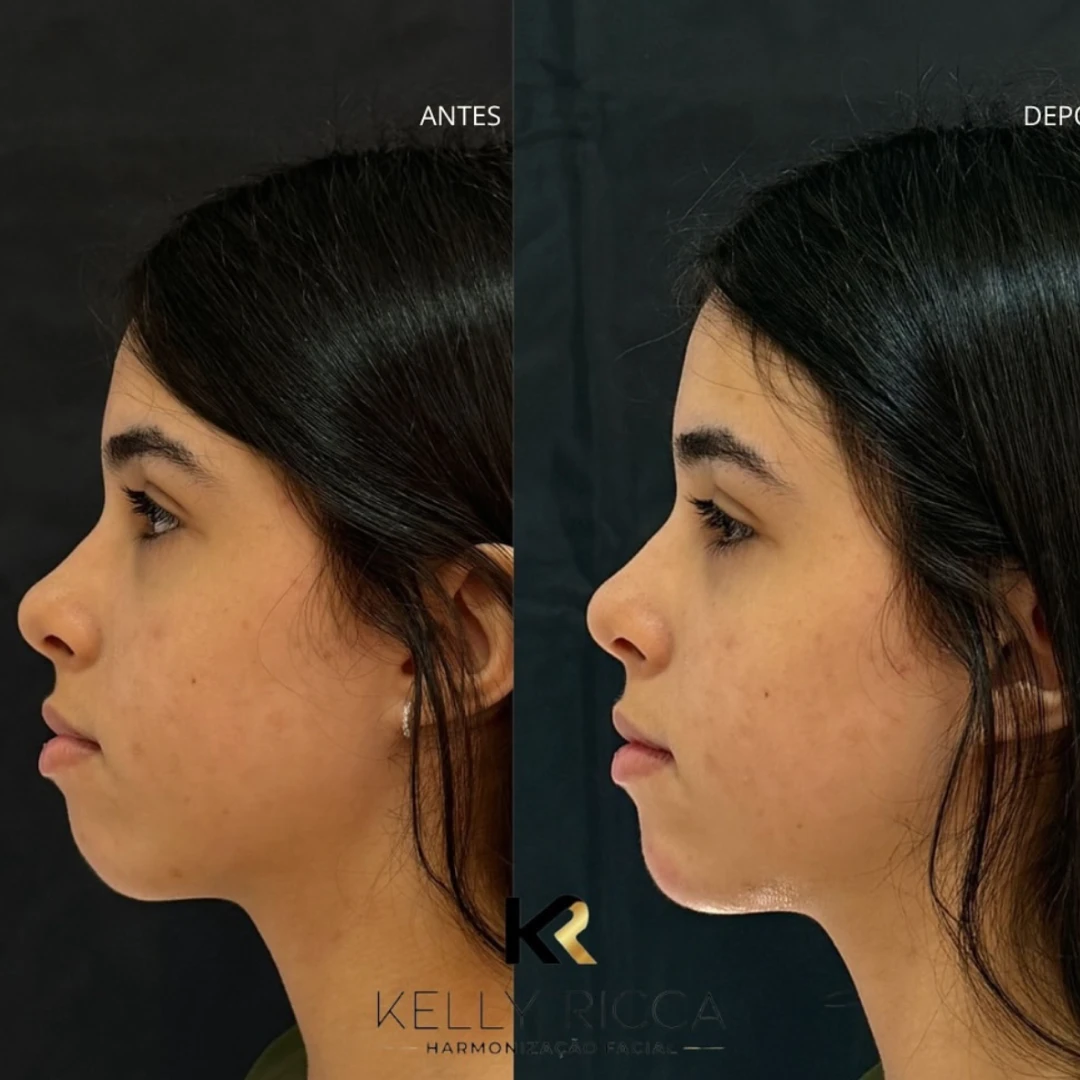 ccc8d1ad_b1db_41a2_938f_422667e4212b_1x